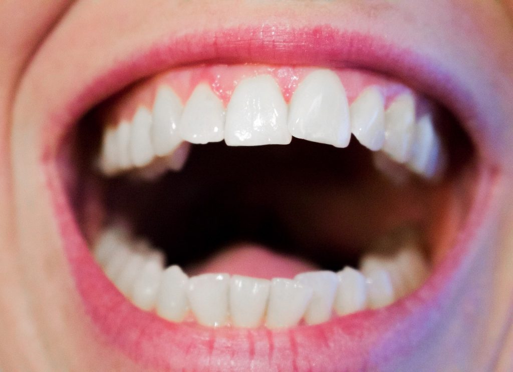 collutorio - sorriso